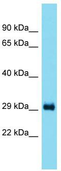 Host: Rabbit; Target Name: Taco1; Sample Tissue: Rat Liver lysates; Antibody Dilution: 1.0ug/ml