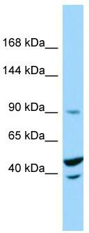 Host: Rabbit; Target Name: TRIM71; Sample Tissue: THP-1 Whole Cell lysates; Antibody Dilution: 1.0ug/ml