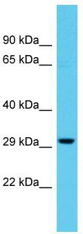 Host: Rabbit; Target Name: TTLL11; Sample Tissue: THP-1 Whole Cell lysates; Antibody Dilution: 1.0ug/ml