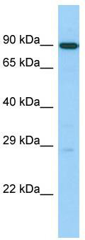 Host: Rabbit; Target Name: UTP14C; Sample Tissue: 721_B Whole Cell lysates; Antibody Dilution: 1.0ug/ml; UTP14C is strongly supported by BioGPS gene expression data to be expressed in Human 721_B cells