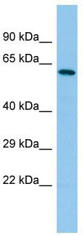 Host: Rabbit; Target Name: YTHDF2; Sample Tissue: MCF7 Whole Cell lysates; Antibody Dilution: 1.0ug/ml