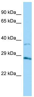 Host: Rabbit; Target Name: AKR1B15; Sample Tissue: HT1080 Whole Cell lysates; Antibody Dilution: 1.0ug/ml