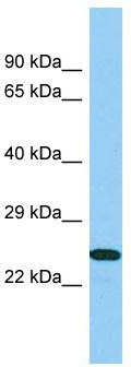 Host: Rabbit; Target Name: B9D1; Sample Tissue: 721_B Whole Cell lysates; Antibody Dilution: 1.0ug/ml