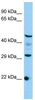 Host: Rabbit; Target Name: C3orf26; Sample Tissue: HepG2 Whole Cell lysates; Antibody Dilution: 1.0ug/ml