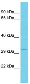 Host: Rabbit; Target Name: C9orf78; Sample Tissue: MCF7 Whole Cell lysates; Antibody Dilution: 1.0ug/ml; C9orf78 is supported by BioGPS gene expression data to be expressed in MCF7