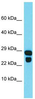 Host: Rabbit; Target Name: IDNK; Sample Tissue: MCF7 Whole Cell lysates; Antibody Dilution: 1.0ug/ml
