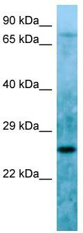 Host: Rabbit; Target Name: C11orf48; Sample Tissue: HepG2 Whole Cell lysates; Antibody Dilution: 1.0ug/ml