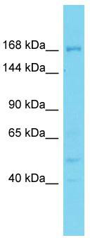 Host: Rabbit; Target Name: DDX60L; Sample Tissue: PANC1 Whole Cell lysates; Antibody Dilution: 1.0ug/ml