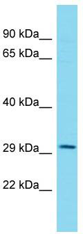 Host: Rabbit; Target Name: DUS4L; Sample Tissue: Hela Whole cell lysates; Antibody Dilution: 1.0ug/ml
