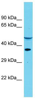 Host: Rabbit; Target Name: DUS4L; Sample Tissue: Placenta lysates; Antibody Dilution: 1.0ug/ml