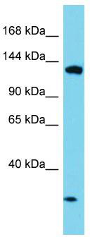 Host: Rabbit; Target Name: EFTUD1; Sample Tissue: HepG2 Whole Cell lysates; Antibody Dilution: 1.0ug/ml