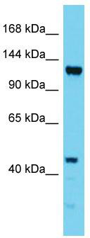 Host: Rabbit; Target Name: EFTUD1; Sample Tissue: HepG2 Whole Cell lysates; Antibody Dilution: 1.0ug/ml