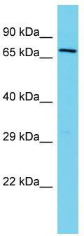 Host: Rabbit; Target Name: FERMT2; Sample Tissue: HT1080 Whole Cell lysates; Antibody Dilution: 1.0ug/ml. FERMT2 is strongly supported by BioGPS gene expression data to be expressed in Human HT1080 cells
