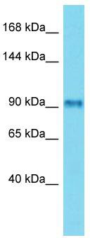 Host: Rabbit; Target Name: FSIP2; Sample Tissue: Placenta lysates; Antibody Dilution: 1.0ug/ml