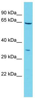 Host: Rabbit; Target Name: IBA57; Sample Tissue: 721_B Whole Cell lysates; Antibody Dilution: 1.0ug/ml