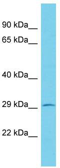 Host: Rabbit; Target Name: KCTD2; Sample Tissue: RPMI-8226 Whole Cell lysates; Antibody Dilution: 1.0ug/ml