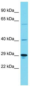 Host: Rabbit; Target Name: KIAA1919; Sample Tissue: Hela Whole Cell lysates; Antibody Dilution: 1.0ug/ml