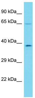 Host: Rabbit; Target Name: KRT73; Sample Tissue: HepG2 Whole Cell lysates; Antibody Dilution: 1.0ug/ml