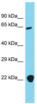 Host: Rabbit; Target Name: AP4B1; Sample Tissue: 293T Whole Cell lysates; Antibody Dilution: 1.0ug/ml