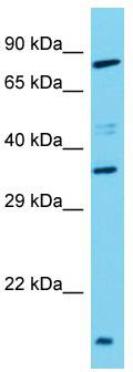 Host: Rabbit; Target Name: TAS2R3; Sample Tissue: Hela Whole Cell lysates; Antibody Dilution: 1.0ug/ml