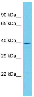 Host: Rabbit; Target Name: ANKRD16; Sample Tissue: Hela Whole cell lysates; Antibody Dilution: 1.0ug/ml