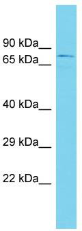 Host: Rabbit; Target Name: KANSL2; Sample Tissue: Placenta lysates; Antibody Dilution: 1.0ug/ml