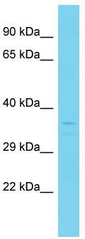 Host: Rabbit; Target Name: C4orf27; Sample Tissue: 721_B Whole Cell lysates; Antibody Dilution: 1.0ug/ml; C4orf27 is supported by BioGPS gene expression data to be expressed in 721_B