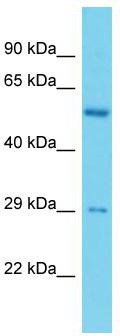 Host: Rabbit; Target Name: C19orf66; Sample Tissue: ACHN Whole cell lysates; Antibody Dilution: 1.0ug/ml