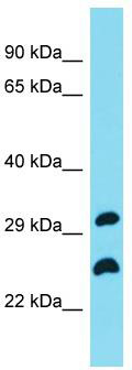 Host: Rabbit; Target Name: C19orf66; Sample Tissue: COLO205 Whole Cell lysates; Antibody Dilution: 1.0ug/ml