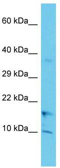 Host: Rabbit; Target Name: COA1; Sample Tissue: Jurkat Whole Cell lysates; Antibody Dilution: 1.0ug/ml; There is BioGPS gene expression data showing that COA1 is expressed in Jurkat