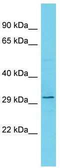 Host: Rabbit; Target Name: TEX13B; Sample Tissue: OVCAR-3 Whole Cell lysates; Antibody Dilution: 1.0ug/ml