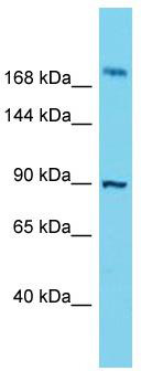 Host: Rabbit; Target Name: STOX2; Sample Tissue: ACHN Whole Cell lysates; Antibody Dilution: 1.0ug/ml