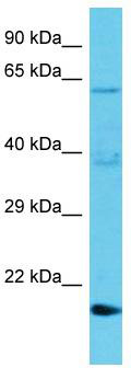 Host: Rabbit; Target Name: TMBIM1; Sample Tissue: Jurkat Whole Cell lysates; Antibody Dilution: 1.0ug/ml