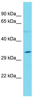 Host: Rabbit; Target Name: OR51B2; Sample Tissue: Jurkat Whole Cell lysates; Antibody Dilution: 1.0ug/ml