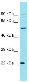 Host: Rabbit; Target Name: CCNJL; Sample Tissue: PANC1 Whole Cell lysates; Antibody Dilution: 1.0ug/ml