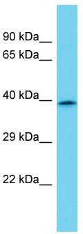 Host: Rabbit; Target Name: CCNJL; Sample Tissue: MDA-MB-435S Whole Cell lysates; Antibody Dilution: 1.0ug/ml