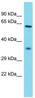 Host: Rabbit; Target Name: NDNF; Sample Tissue: Jurkat Whole Cell lysates; Antibody Dilution: 1.0ug/ml