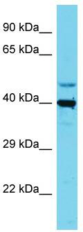 Host: Rabbit; Target Name: SLC35E1; Sample Tissue: HepG2 Whole Cell lysates; Antibody Dilution: 1.0ug/ml