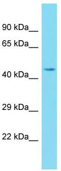 Host: Rabbit; Target Name: C5orf44; Sample Tissue: MCF7 Whole Cell lysates; Antibody Dilution: 1.0ug/ml