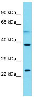 Host: Rabbit; Target Name: C2orf44; Sample Tissue: Jurkat Whole Cell lysates; Antibody Dilution: 1.0ug/ml; C2orf44 is supported by BioGPS gene expression data to be expressed in Jurkat