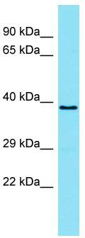 Host: Rabbit; Target Name: TMEM121; Sample Tissue: ACHN Whole Cell lysates; Antibody Dilution: 1.0ug/ml
