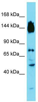 Host: Rabbit; Target Name: SYDE2; Sample Tissue: Fetal Liver lysates; Antibody Dilution: 1.0 ug/ml.