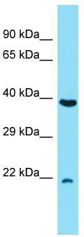 Host: Rabbit; Target Name: C7orf50; Sample Tissue: RPMI-8226 Whole Cell lysates; Antibody Dilution: 1.0 ug/ml.