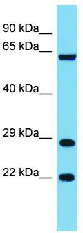 Host: Rabbit; Target Name: FAM220A; Sample Tissue: COLO205 Whole Cell lysates; Antibody Dilution: 1.0 ug/ml.