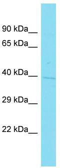 Host: Rabbit; Target Name: C1orf198; Sample Tissue: NCI-H226 Whole Cell lysates; Antibody Dilution: 1.0 ug/ml.