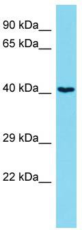 Typical titration curve of Endothelin-1 in a competitive ELISA with this antibody