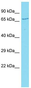 Host: Rabbit; Target Name: CCDC120; Sample Tissue: Hela Whole cell lysates; Antibody Dilution: 1.0 ug/ml.