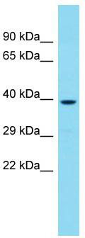 Host: Rabbit; Target Name: CCDC97; Sample Tissue: 721_B Whole Cell lysates; Antibody Dilution: 1.0 ug/ml.