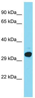 Host: Rabbit; Target Name: C15orf23; Sample Tissue: HepG2 Whole Cell lysates; Antibody Dilution: 1.0 ug/ml.