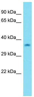 Host: Rabbit; Target Name: C15orf23; Sample Tissue: MDA-MB-435S Whole Cell lysates; Antibody Dilution: 1.0 ug/ml.